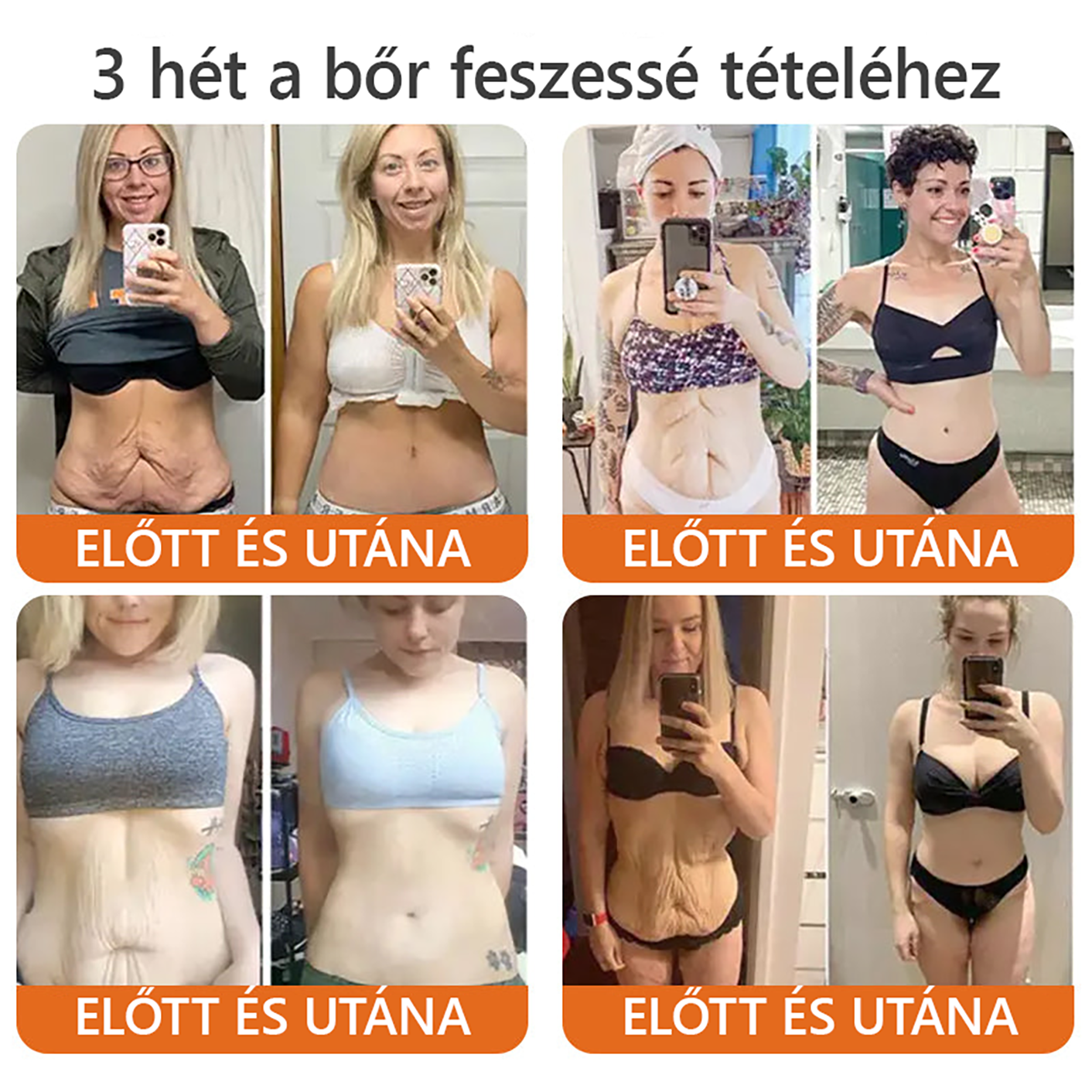 🌿 Bőrgyógyász ajánlása ✨ ZödVita® Méhméreg Bőr Helyreállító Krém 🔥 Magyar fejlesztés, magyarországi gyártás és szállítás