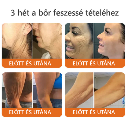 🌿 Bőrgyógyász ajánlása ✨ ZödVita® Méhméreg Bőr Helyreállító Krém 🔥 Magyar fejlesztés, magyarországi gyártás és szállítás