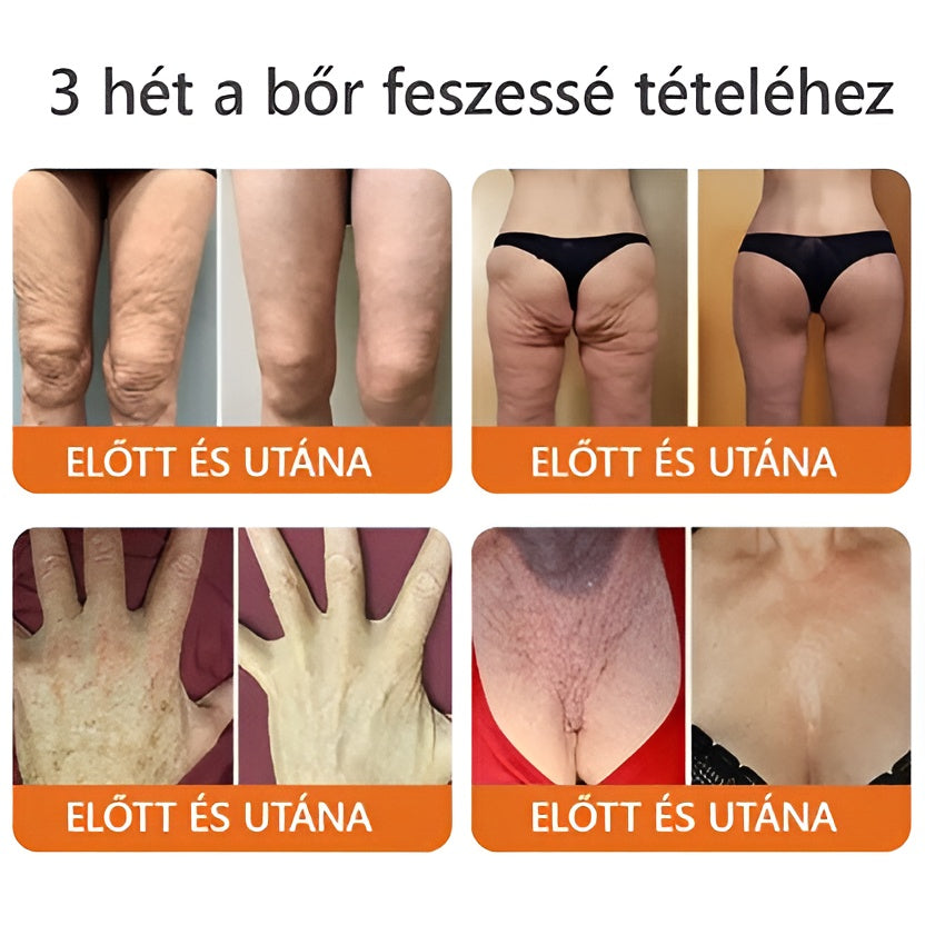🌿 Bőrgyógyász ajánlása ✨ ZödVita® Méhméreg Bőr Helyreállító Krém 🔥 Magyar fejlesztés, magyarországi gyártás és szállítás