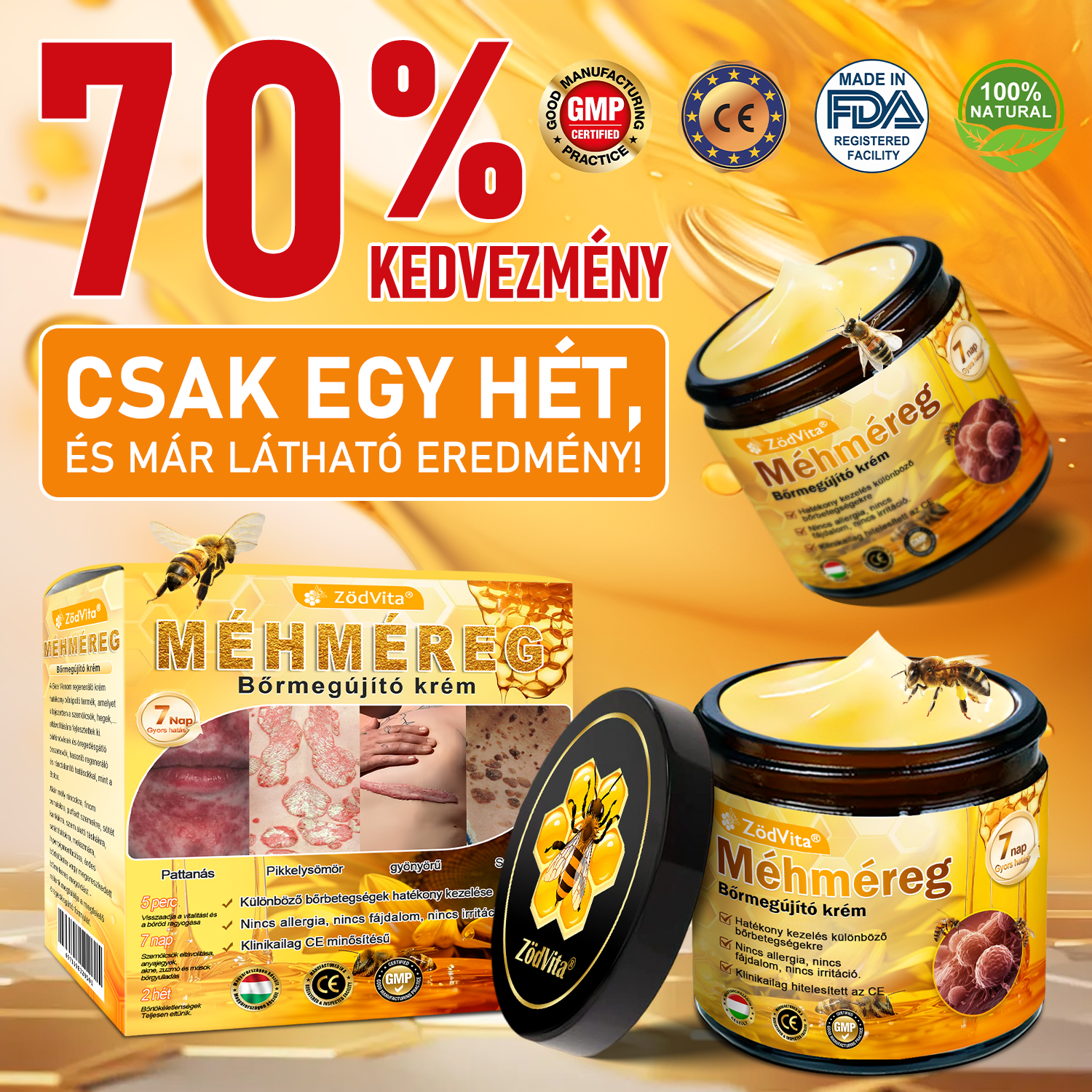🌿 Bőrgyógyász ajánlása ✨ ZödVita® Méhméreg Bőr Helyreállító Krém 🔥 Magyar fejlesztés, magyarországi gyártás és szállítás