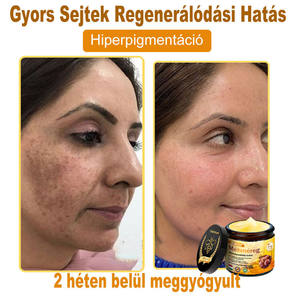 🌿 Bőrgyógyász ajánlása ✨ ZödVita® Méhméreg Bőr Helyreállító Krém 🔥 Magyar fejlesztés, magyarországi gyártás és szállítás