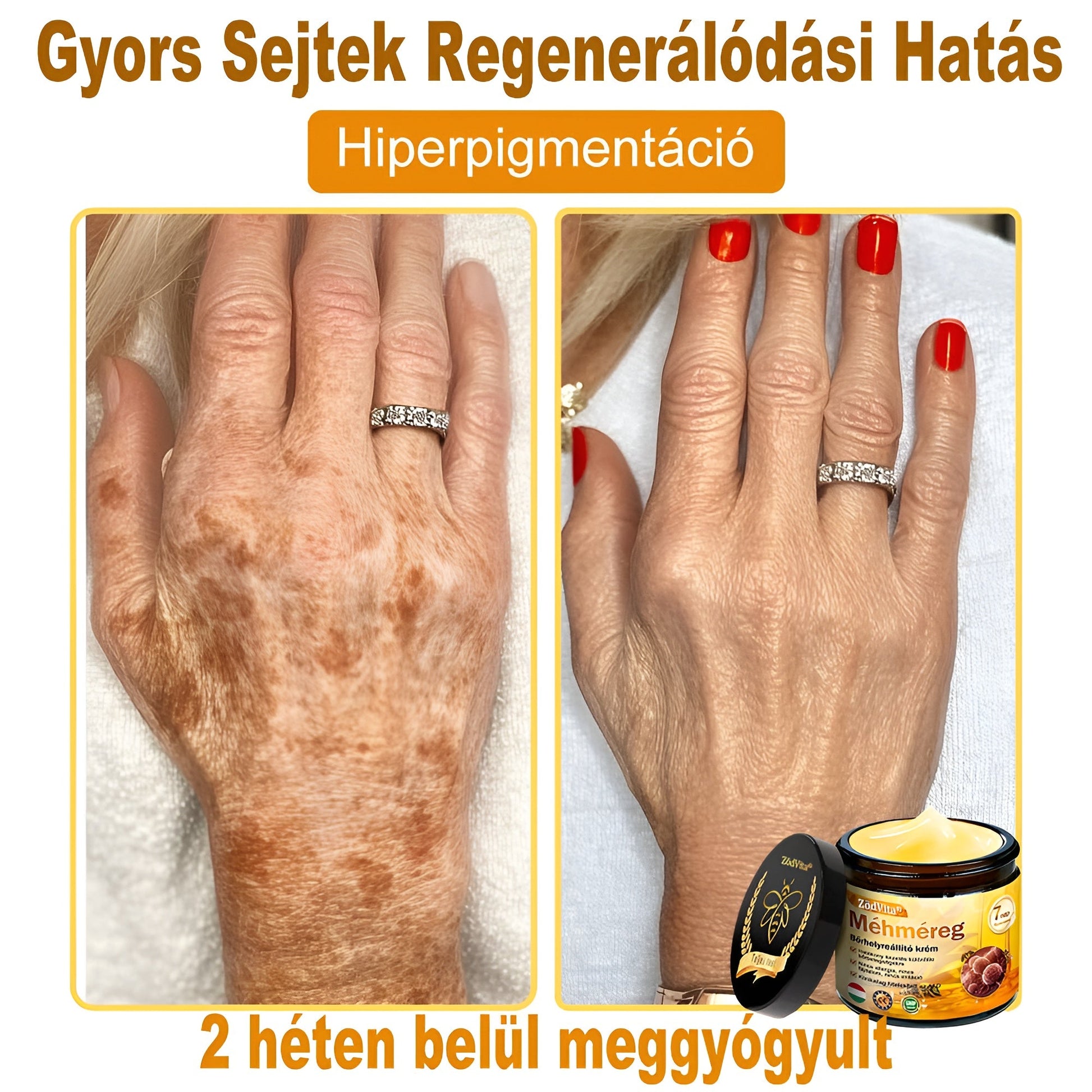 🌿 Bőrgyógyász ajánlása ✨ ZödVita® Méhméreg Bőr Helyreállító Krém 🔥 Magyar fejlesztés, magyarországi gyártás és szállítás