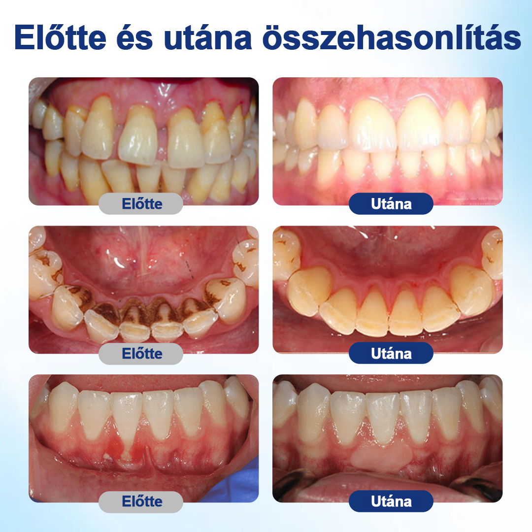 🌲HEATWOLF® BeeTakt Szájápoló Regeneráló Oldat 🦷Fejlett bioaktív formula a szájüreg átfogó regeneráló támogatására