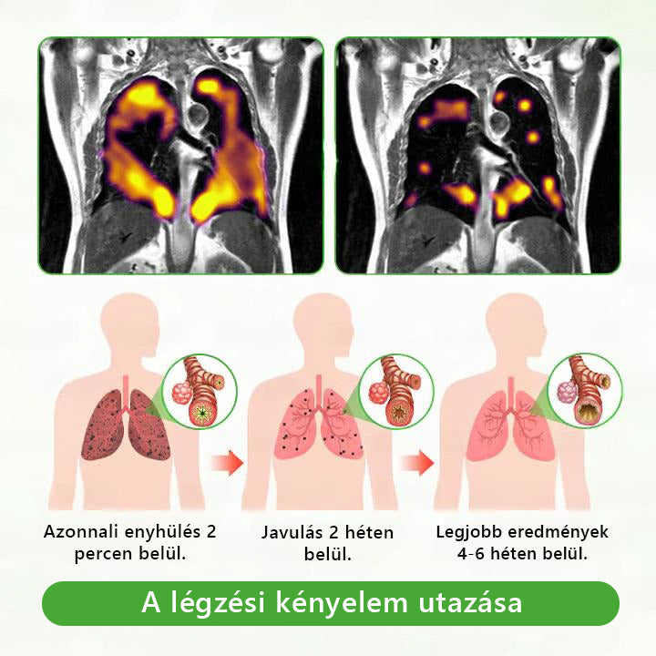 Magyar tulajdonban és üzemeltetésben ✅ Murwon® botanikus ökörfarkkóró (Mullein) tüdőtisztító diffúzor (🫁 köhögés, garatgyulladás, légszomj, köpet, orrdugulás, hörghurut, hörghurut, allergiás tünetek, tüdő diszkomfort) 💚