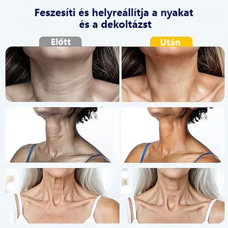 Pannon Patika®Rollerball masszázs nyakkrém 🧴 Kollagén és hialuronsav | Feszesíti a nyakat, csökkenti a nyaki ráncokat és a tokát