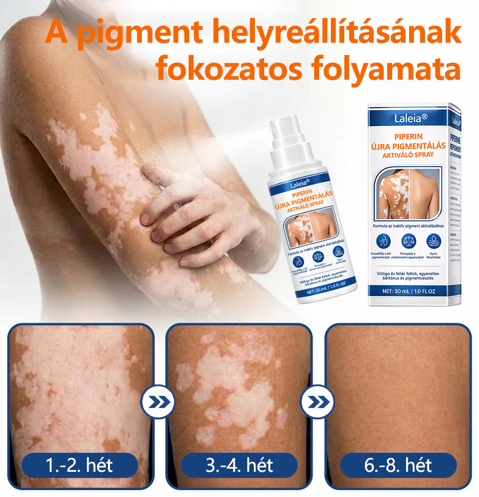 🔥🔥Laleia® Piperine Repigment Aktivátor Spray