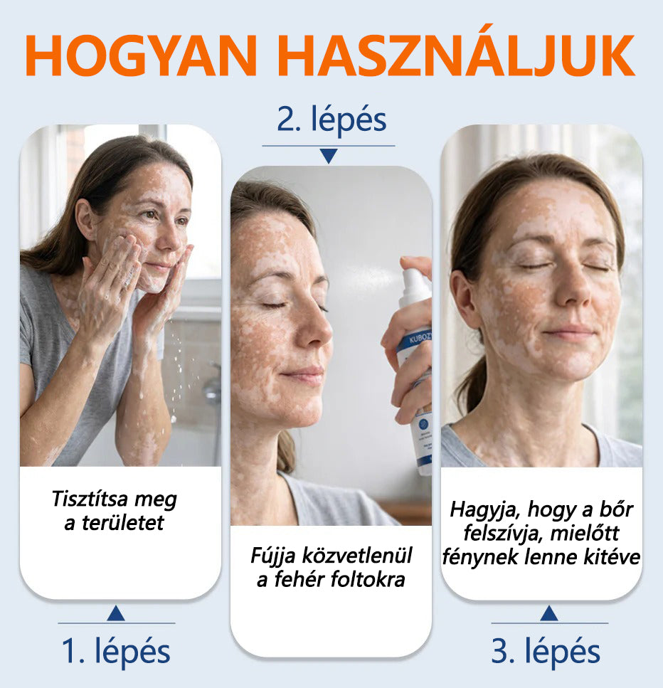 🔥🔥Laleia® Piperine Repigment Aktivátor Spray