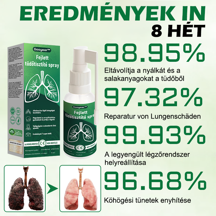 🍈🍈𝐆𝐨𝐨𝐲𝐞𝐞𝐫™ Fejlett Tüdőtisztító Spray -Támogatja a tüdő, a hörgők és az orrmelléküregek egészségét, elősegíti a légzőrendszer egészségét és a könnyebb légzést