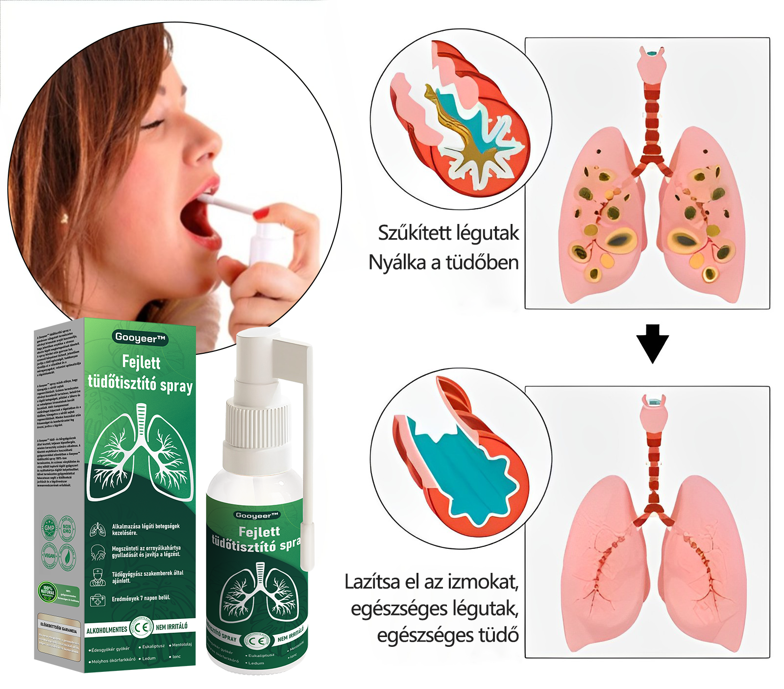 🍈🍈𝐆𝐨𝐨𝐲𝐞𝐞𝐫™ Fejlett Tüdőtisztító Spray -Támogatja a tüdő, a hörgők és az orrmelléküregek egészségét, elősegíti a légzőrendszer egészségét és a könnyebb légzést