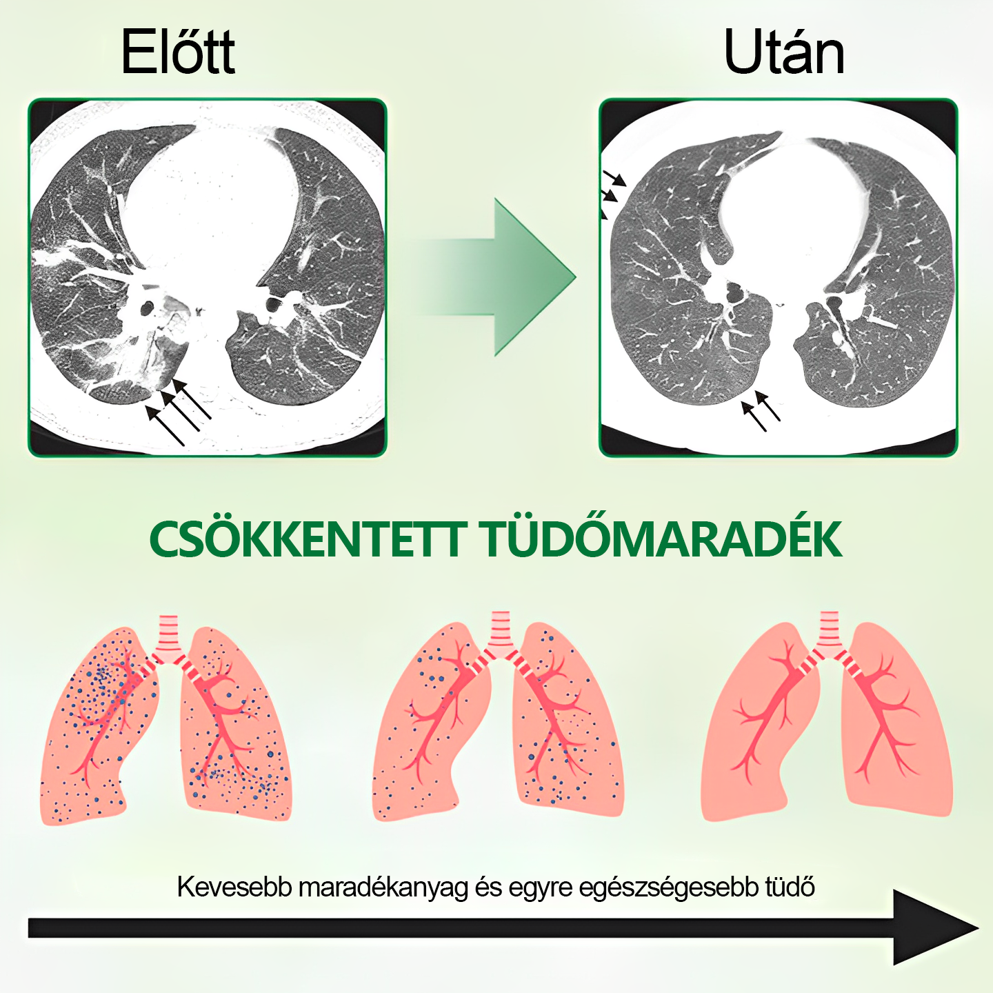 🍈🍈𝐆𝐨𝐨𝐲𝐞𝐞𝐫™ Fejlett Tüdőtisztító Spray -Támogatja a tüdő, a hörgők és az orrmelléküregek egészségét, elősegíti a légzőrendszer egészségét és a könnyebb légzést