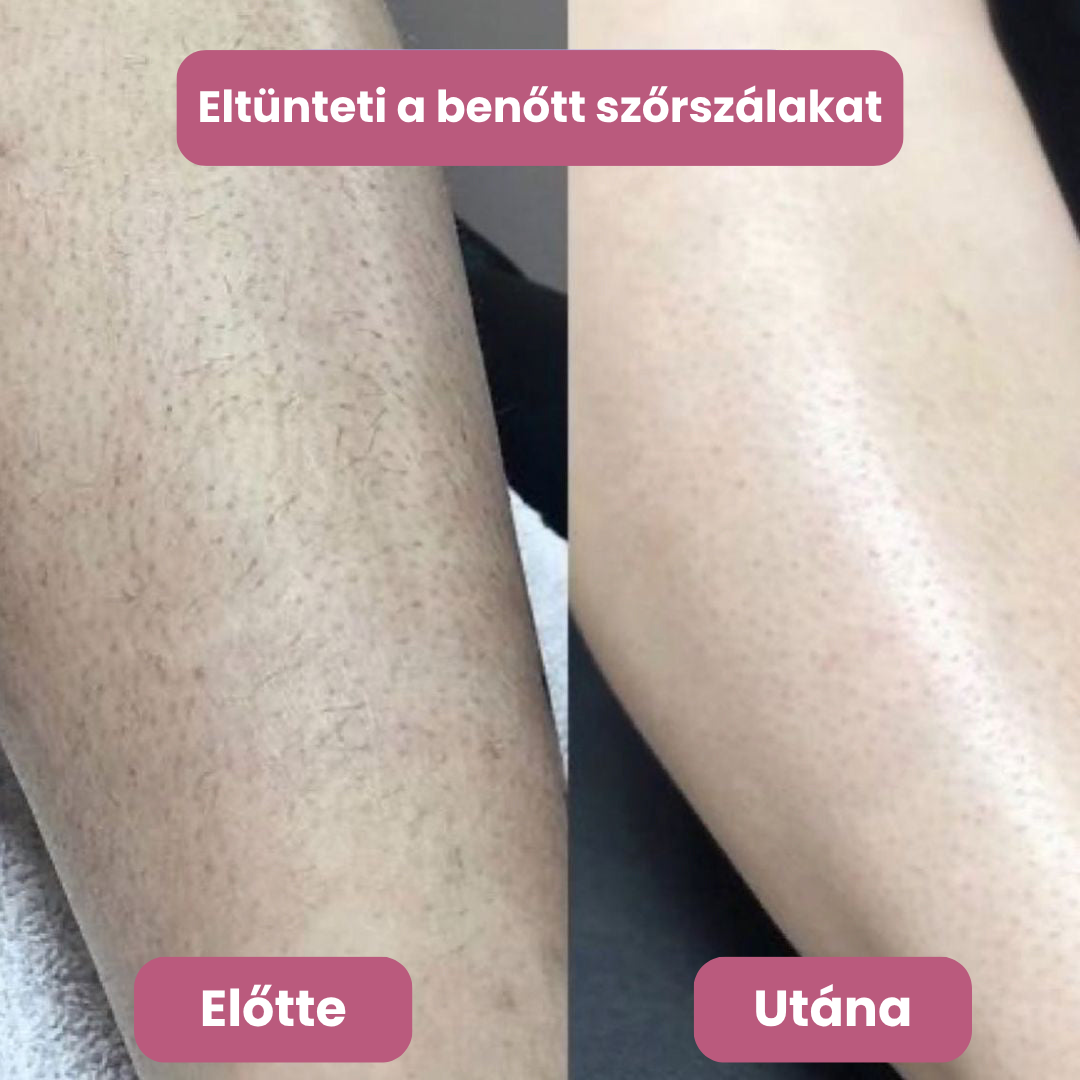 Pannon Patika -Trimmelő