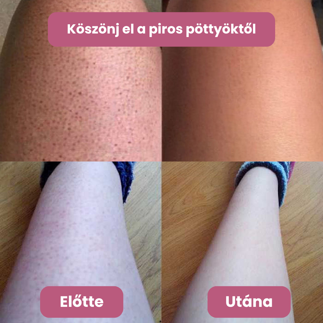 Pannon Patika -Trimmelő