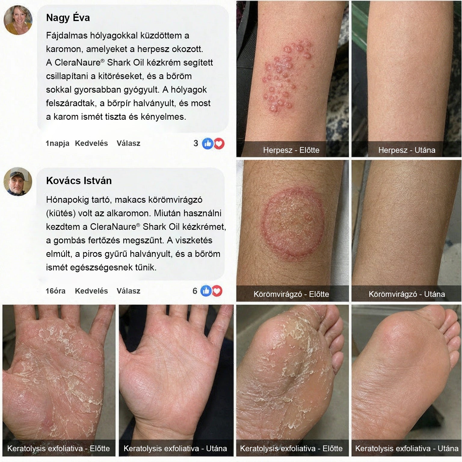 🥇CleraNaure® Cápaolajos Kézápoló Krém