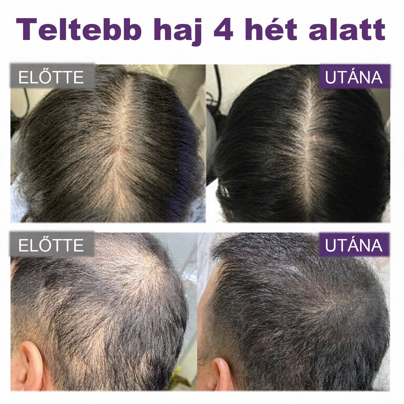 💎CleraNaure® Fekete rizs és vöröshagyma hajnövekedést támogató spray