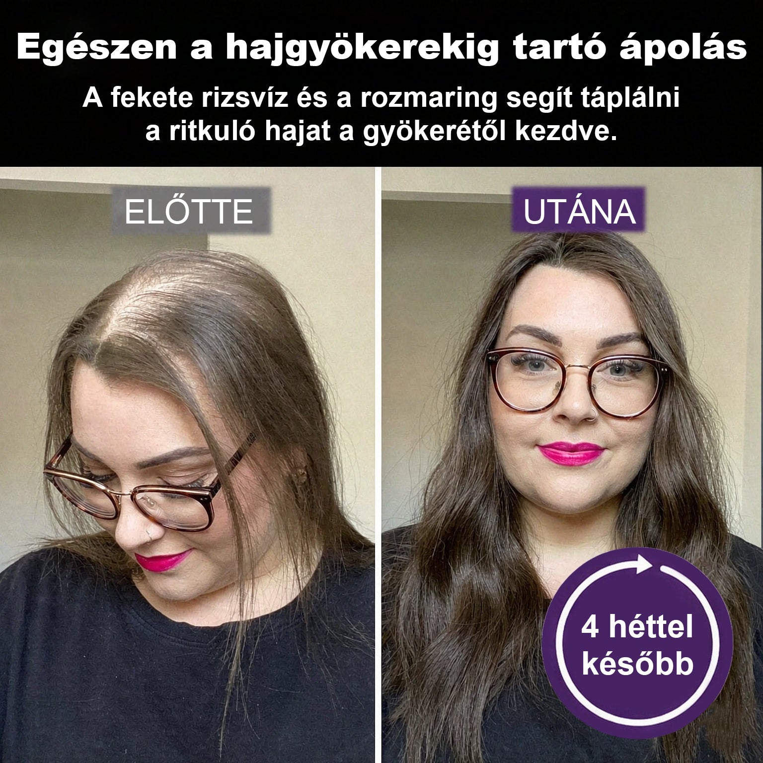 💎CleraNaure® Fekete rizs és vöröshagyma hajnövekedést támogató spray