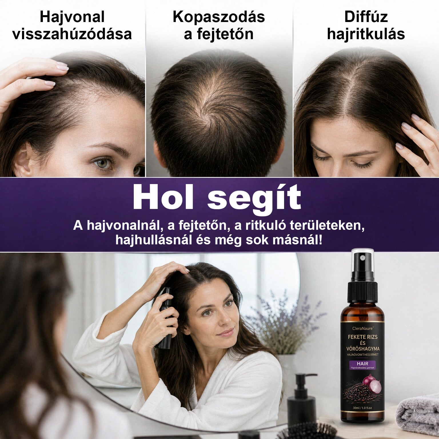 💎CleraNaure® Fekete rizs és vöröshagyma hajnövekedést támogató spray
