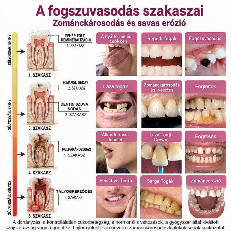 🛡️CleraNaure® DenPerm Üregjavító Természetes Zománctömő Gél