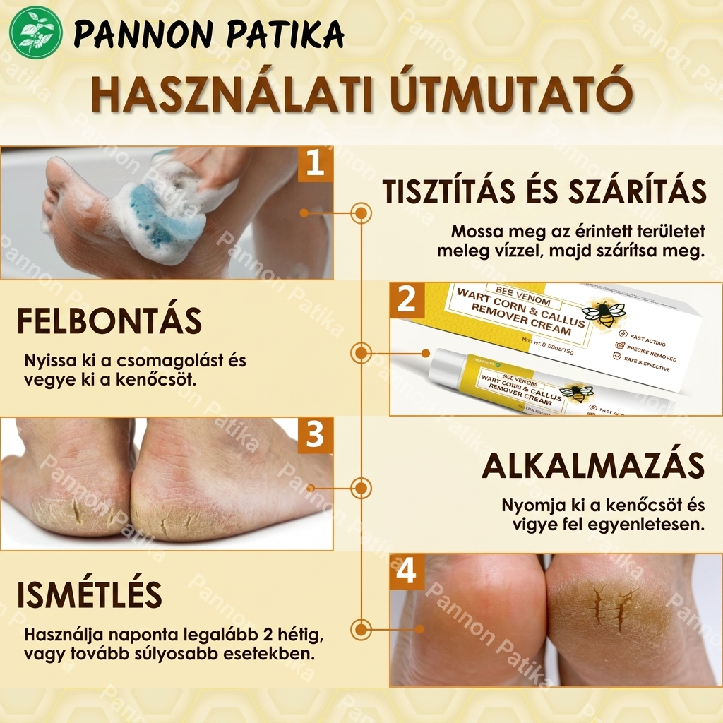 🐝 Méhméreges tyúkszem- és bőrkeményedés-eltávolító krém – Természetes erővel a makacs elváltozások ellen!