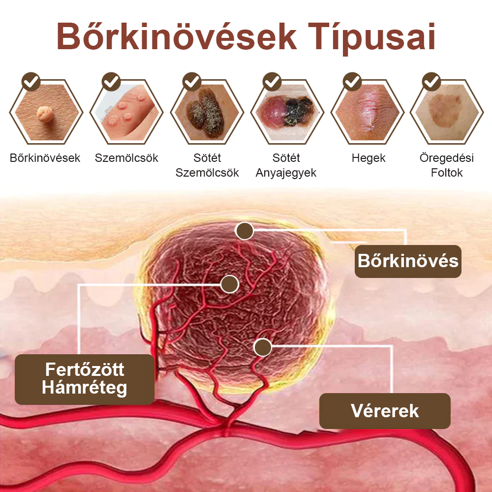 💥 Pureluxo® Fekete Rizses Bőrregeneráló Krém 👨‍⚕️ (Szemölcsök, bőrkinövések, foltok és hiperpigmentáció kezelésére)