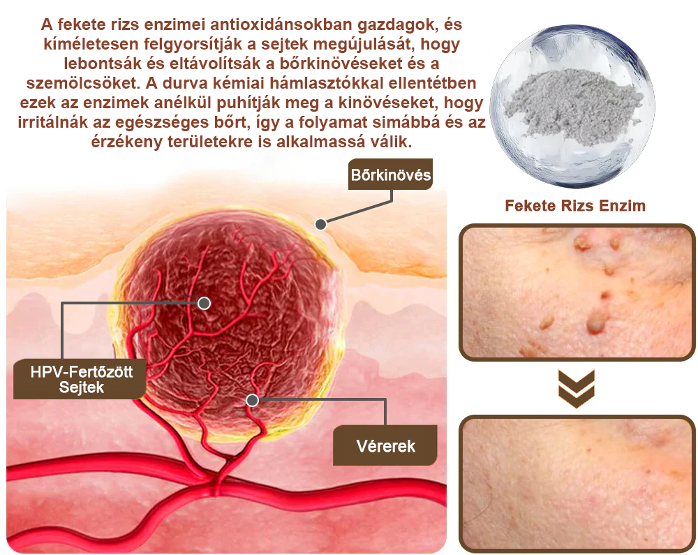 💥 Pureluxo® Fekete Rizses Bőrregeneráló Krém 👨‍⚕️ (Szemölcsök, bőrkinövések, foltok és hiperpigmentáció kezelésére)