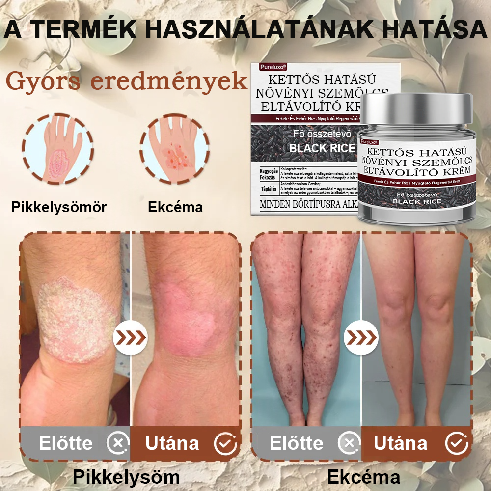 💥 Pureluxo® Fekete Rizses Bőrregeneráló Krém 👨‍⚕️ (Szemölcsök, bőrkinövések, foltok és hiperpigmentáció kezelésére)