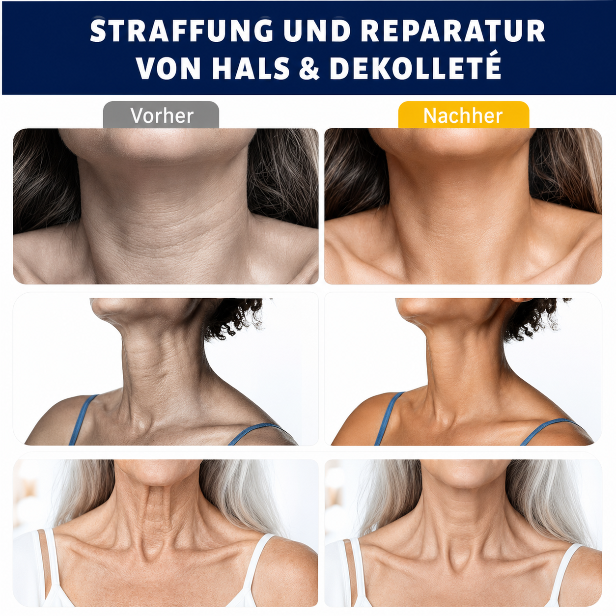 ✨ Roller-Massagecreme — 🧴 Mit Retinol & Hyaluronsäure | Strafft den Hals, Reduziert Falten & Doppelkinn | Beliebt in Deutschland 🇩🇪