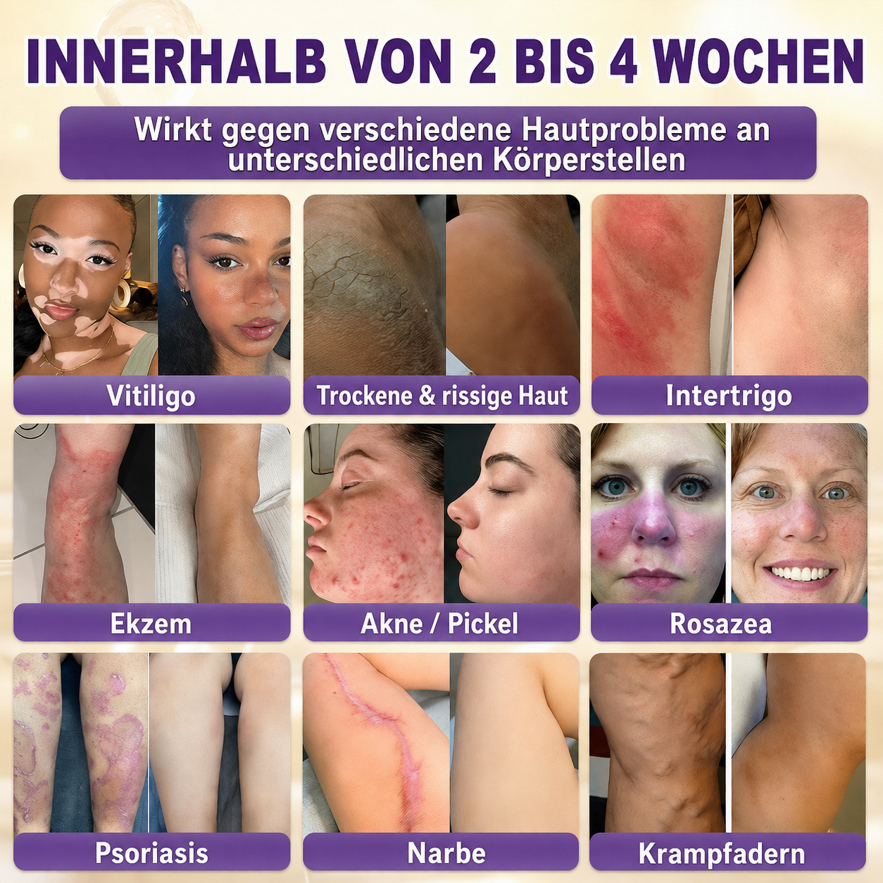 Hergestellt und versendet aus Deutschland ✨slimveron® Biotin 10-in-1 Skin Restoration Cream 🍀