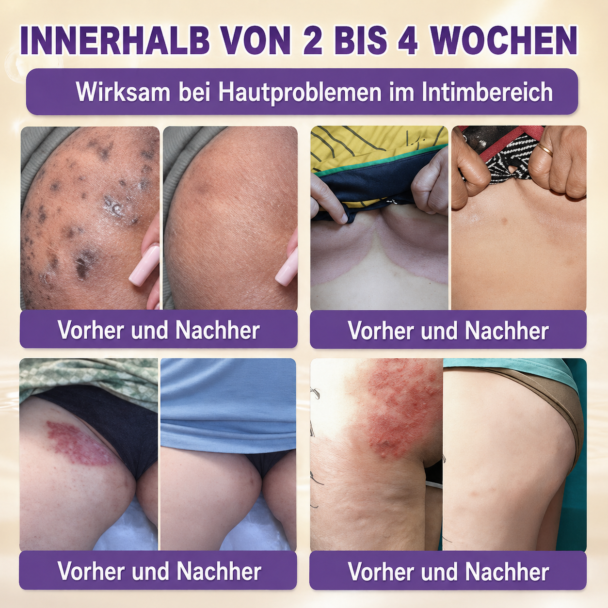 Hergestellt und versendet aus Deutschland ✨slimveron® Biotin 10-in-1 Skin Restoration Cream 🍀