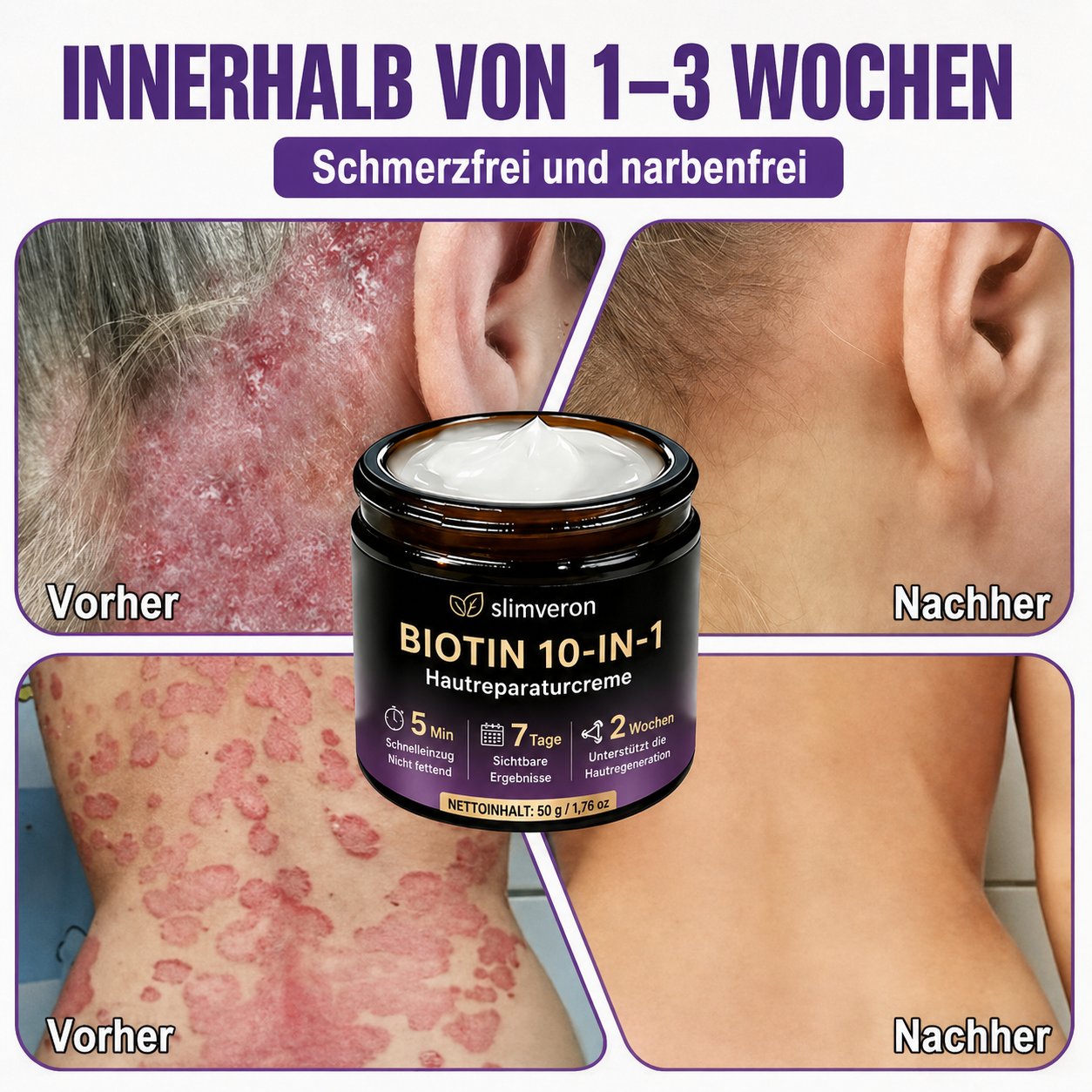 Hergestellt und versendet aus Deutschland ✨slimveron® Biotin 10-in-1 Skin Restoration Cream 🍀