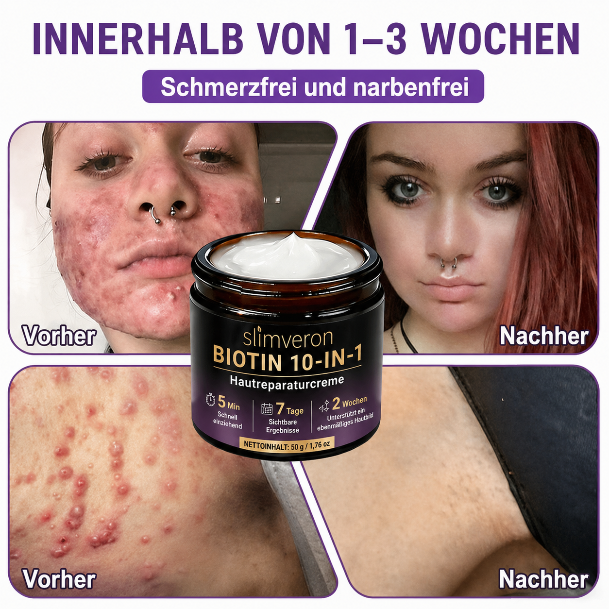 Hergestellt und versendet aus Deutschland ✨slimveron® Biotin 10-in-1 Skin Restoration Cream 🍀