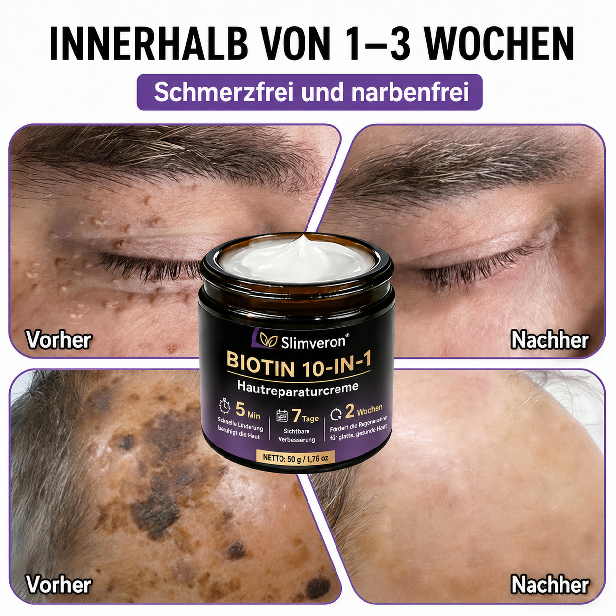 Hergestellt und versendet aus Deutschland ✨slimveron® Biotin 10-in-1 Skin Restoration Cream 🍀