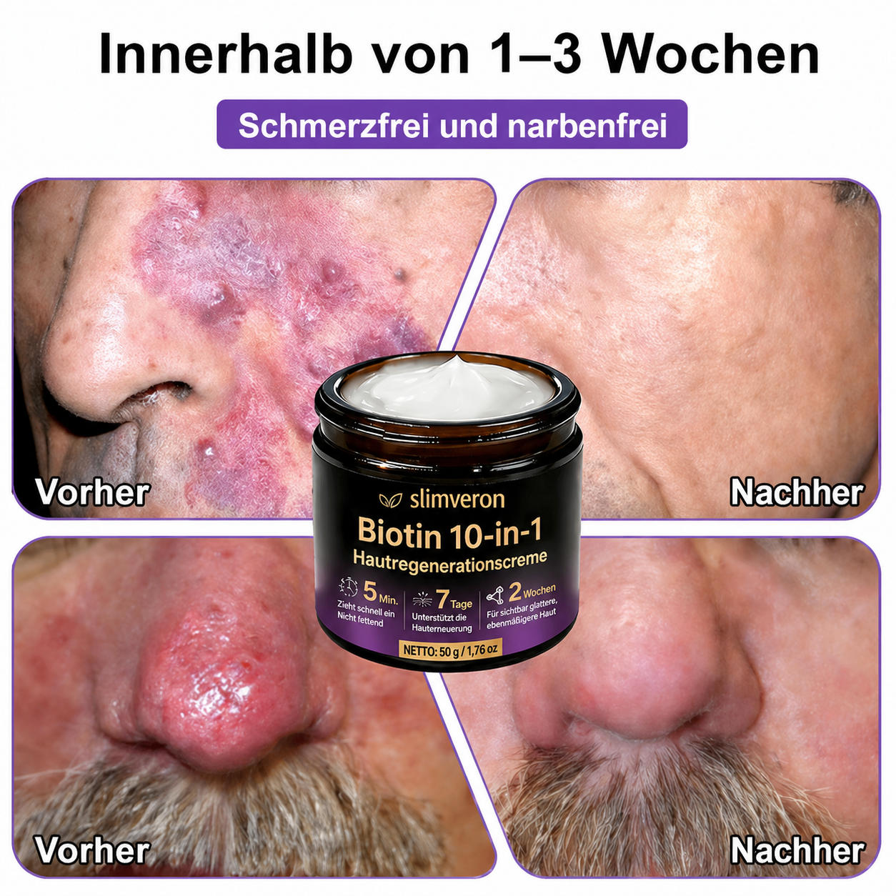 Hergestellt und versendet aus Deutschland ✨slimveron® Biotin 10-in-1 Skin Restoration Cream 🍀