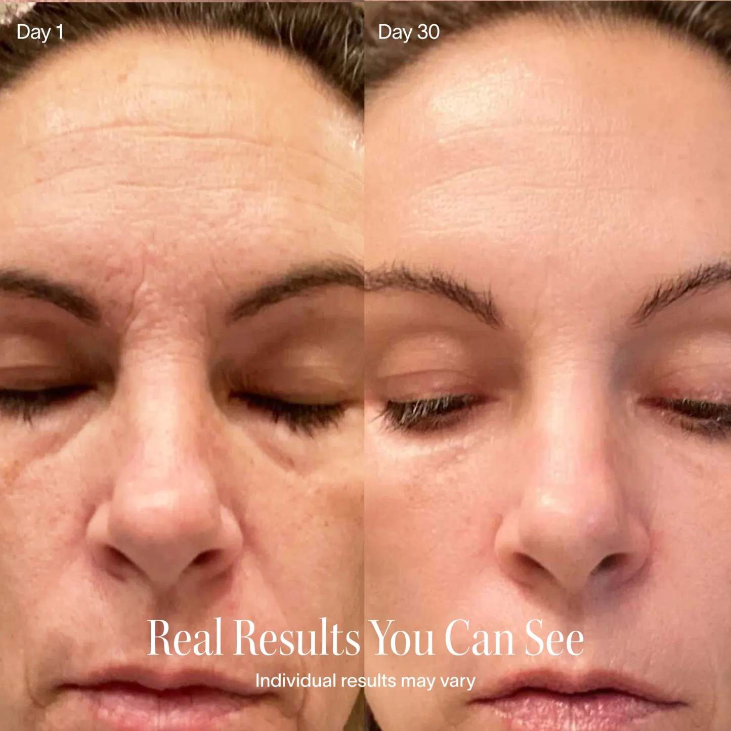 4-in-1 Red Light Therapy Beauty Wand – Facial Massager with Galvanic Current & Warm Care