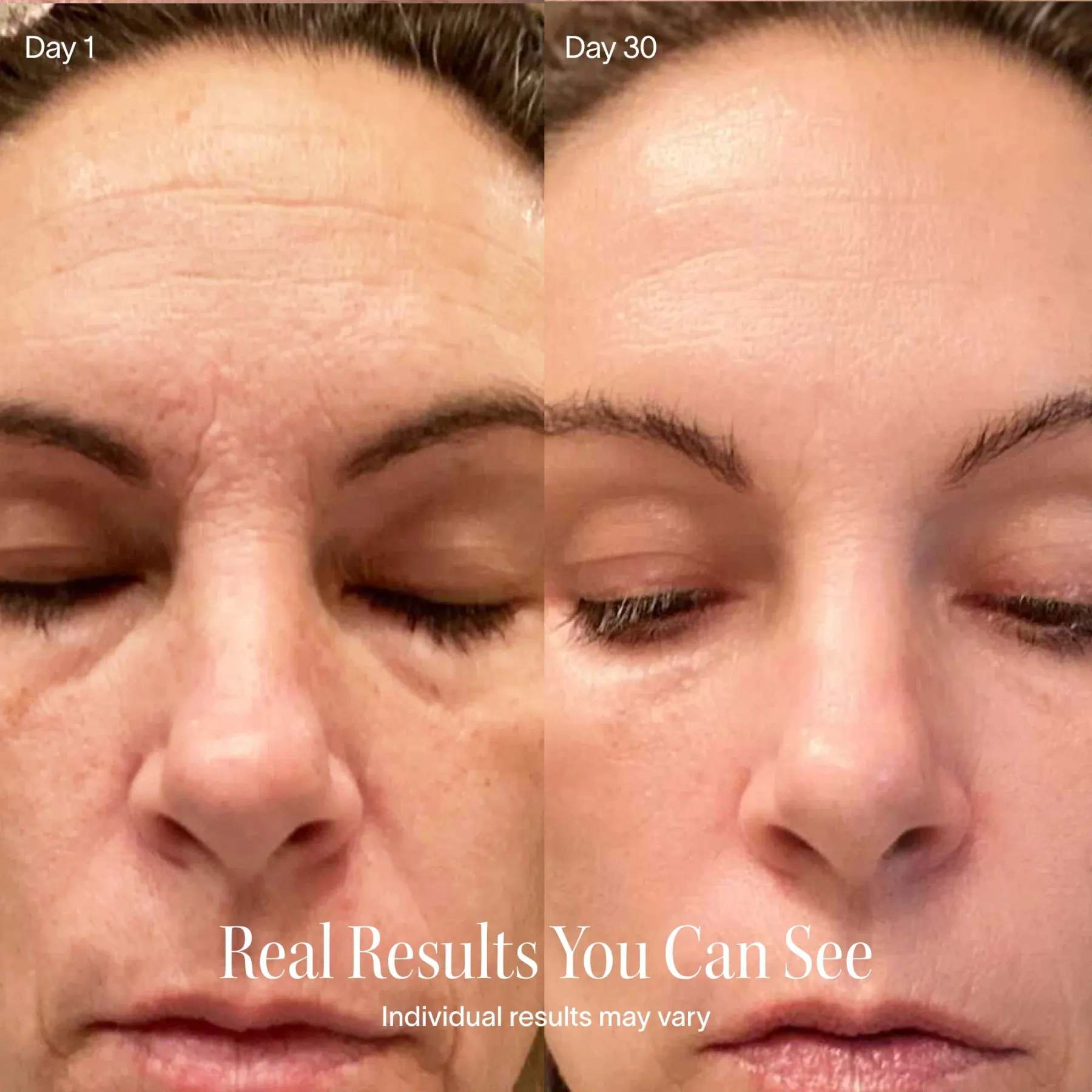 4-in-1 Red Light Therapy Beauty Wand – Facial Massager with Galvanic Current & Warm Care