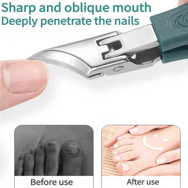 🔥 Eagle Beak Angled Nail Clippers 3-Piece Set