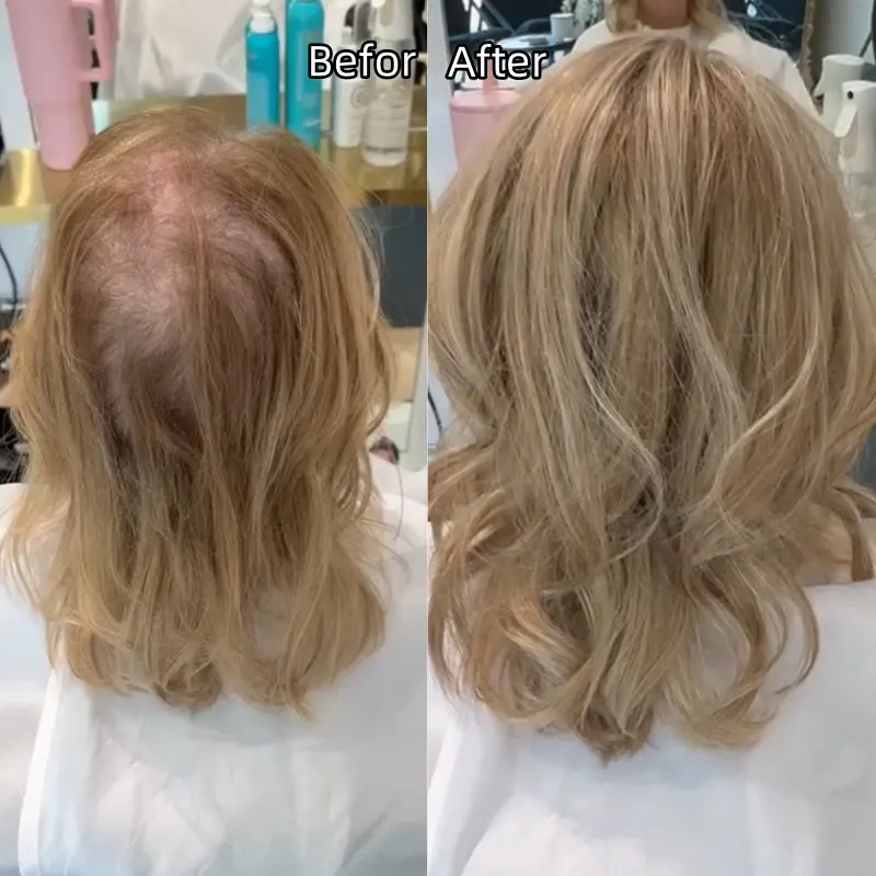 ⚡FINAL HOURS: 50% OFF🌷2026 New Lightweight & Breathable Wavy Hair Topper