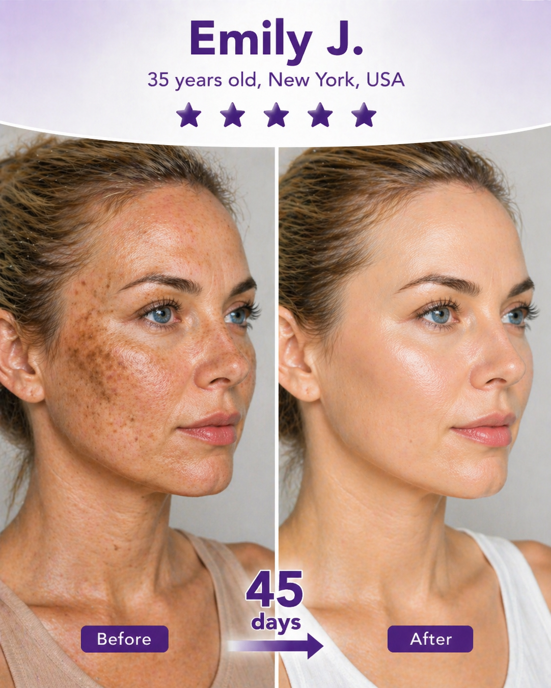 Dark Spots Before & After
