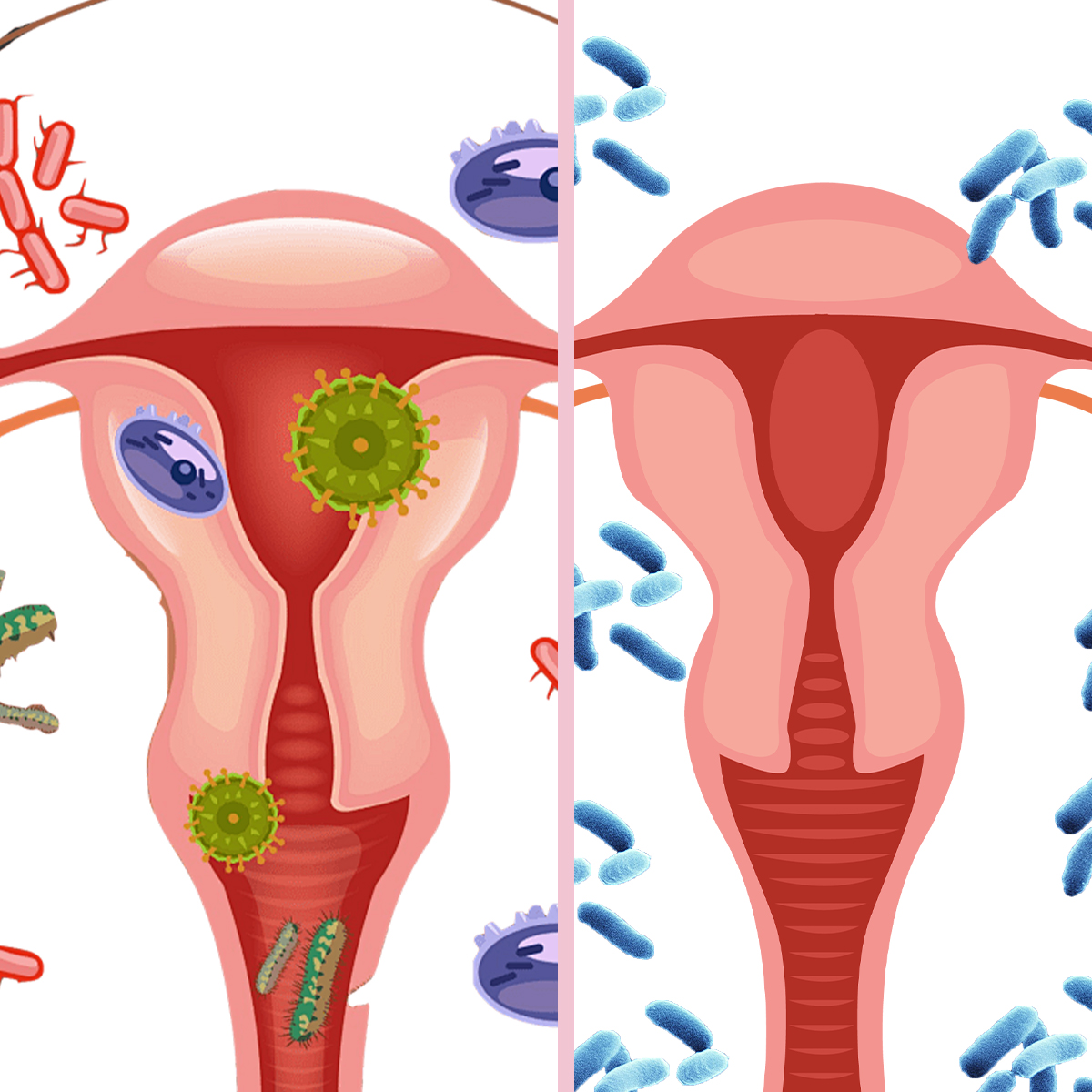 Fairy Secret V-Fresh Restore Gel Intimate Care for Women with Natural Plant Extracts & Probiotics for pH Balance Odor Relief & Lasting Moisture