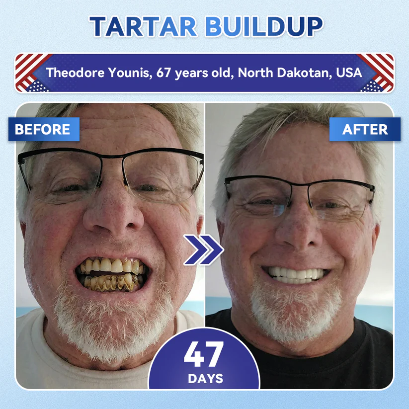Alisanda®🦷 Tideglusib Fast‑Dissolving Tooth & Gum Repair Oral Strips ✨