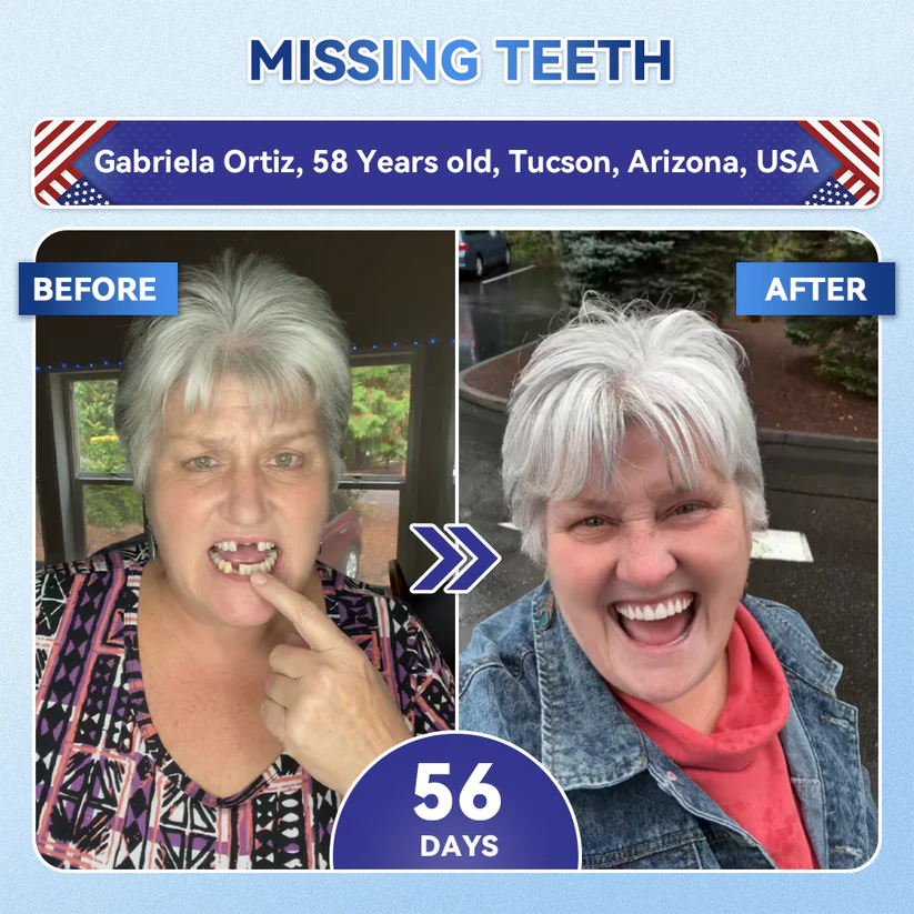 Alisanda®🦷 Tideglusib Fast‑Dissolving Tooth & Gum Repair Oral Strips ✨