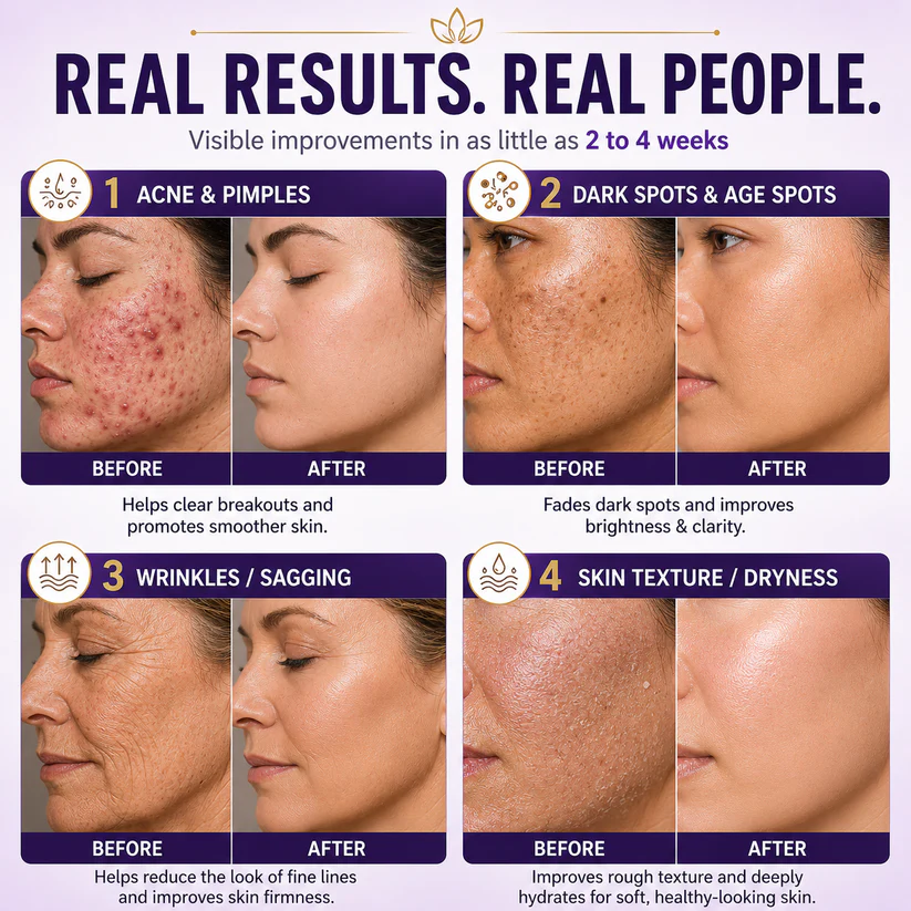  Biotin 10-in-1 Skin Restoration Cream