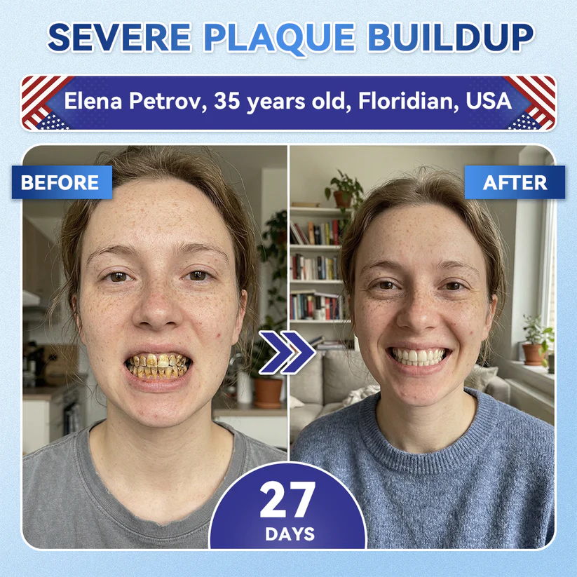 Alisanda®🦷 Tideglusib Fast‑Dissolving Tooth & Gum Repair Oral Strips ✨