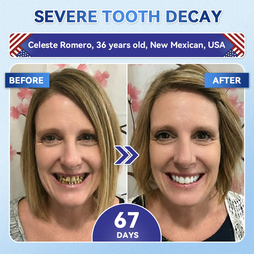 Alisanda®🦷 Tideglusib Fast‑Dissolving Tooth & Gum Repair Oral Strips ✨