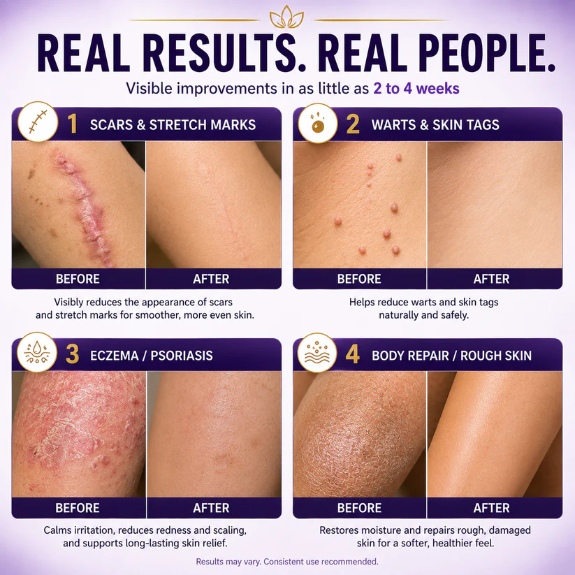  Biotin 10-in-1 Skin Restoration Cream