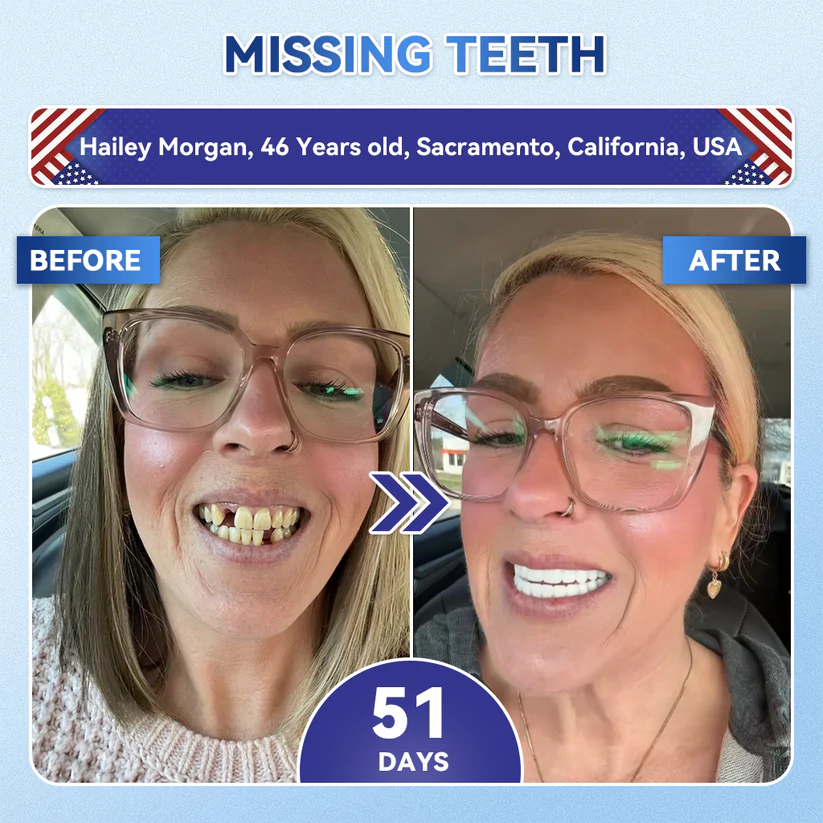Alisanda®🦷 Tideglusib Fast‑Dissolving Tooth & Gum Repair Oral Strips ✨