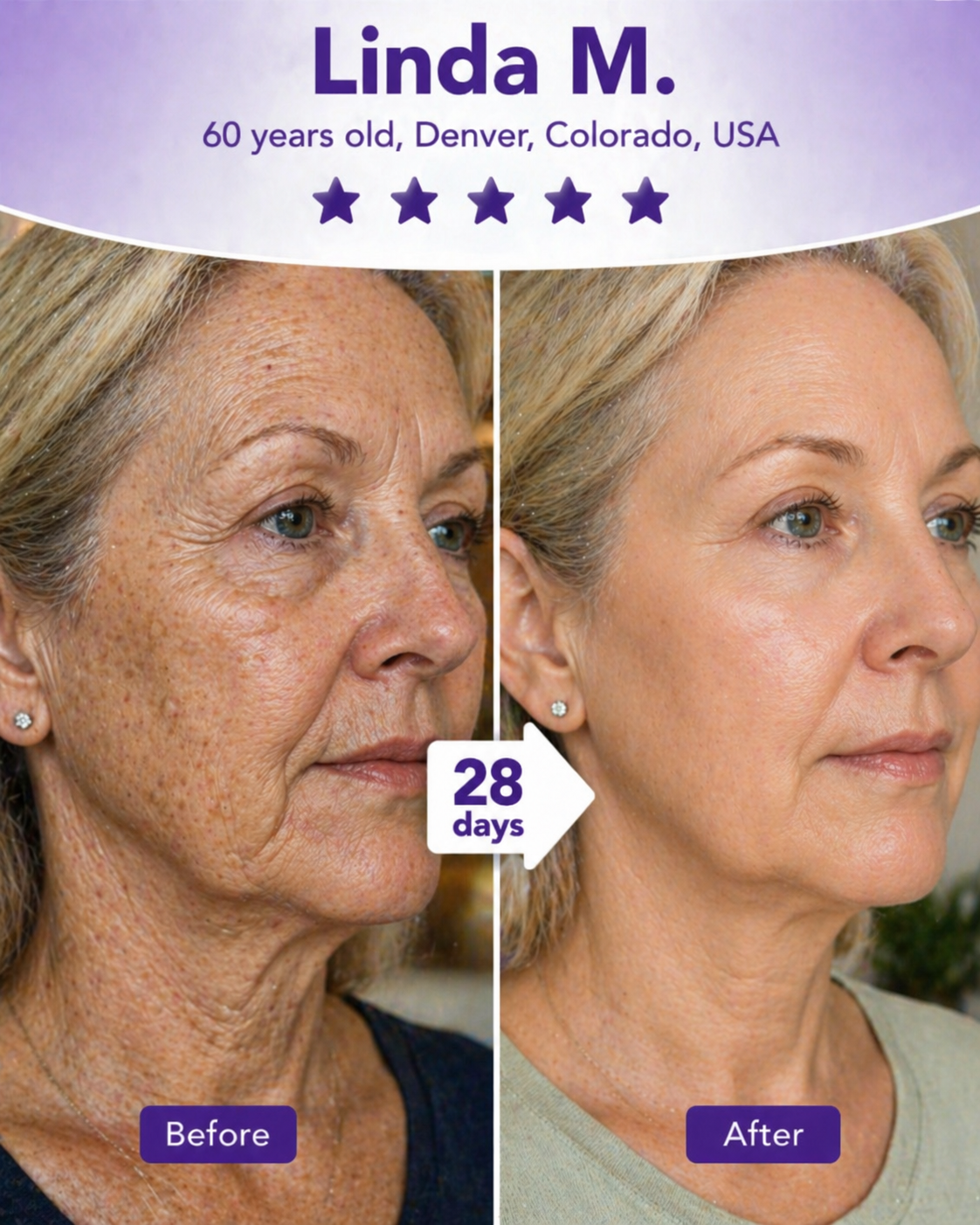 Anti-Aging Before & After
