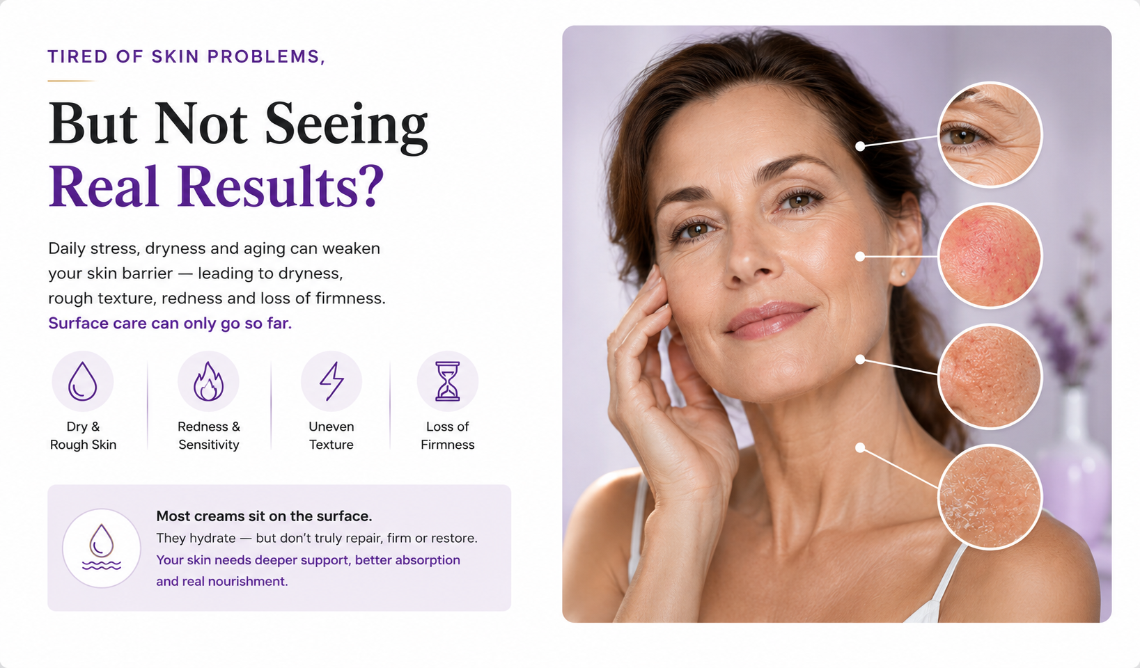 Elivessa skin concerns and surface hydration problem