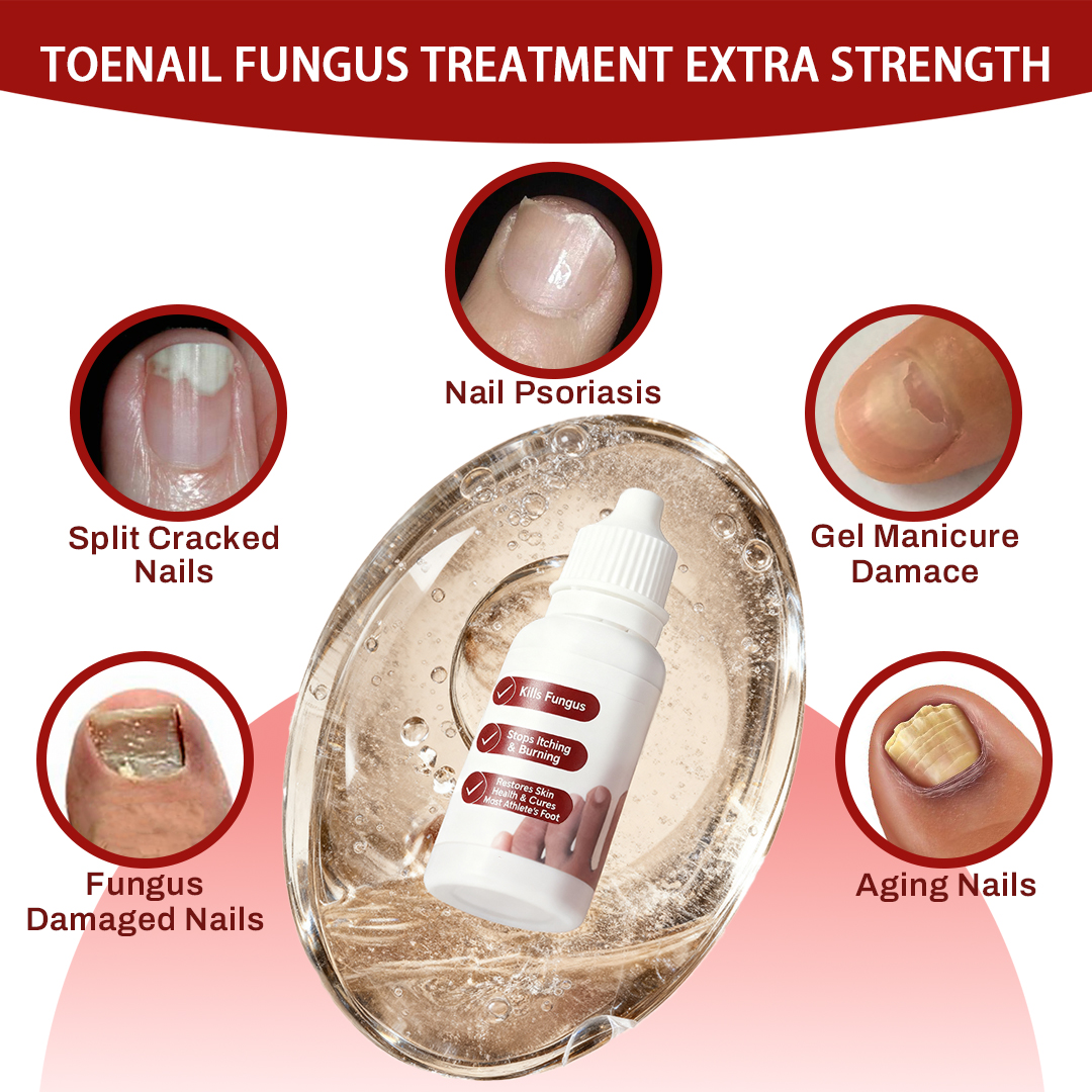 SOVS Toenail Fungus Treatment Extra Strength, Antifungal Solution for Toenail or Fingernail, Triple Action Formula for Remove Fungal, Repair and Renewal Damaged Nails, 0.5 Fl Oz
