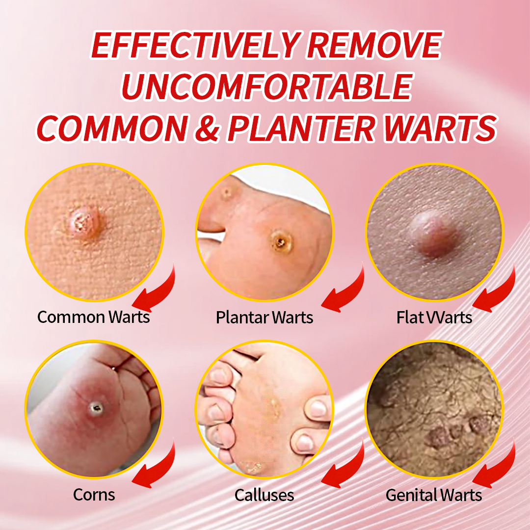 DERMFREE Wart & Corn Remover Pads - One Step Topical Pads