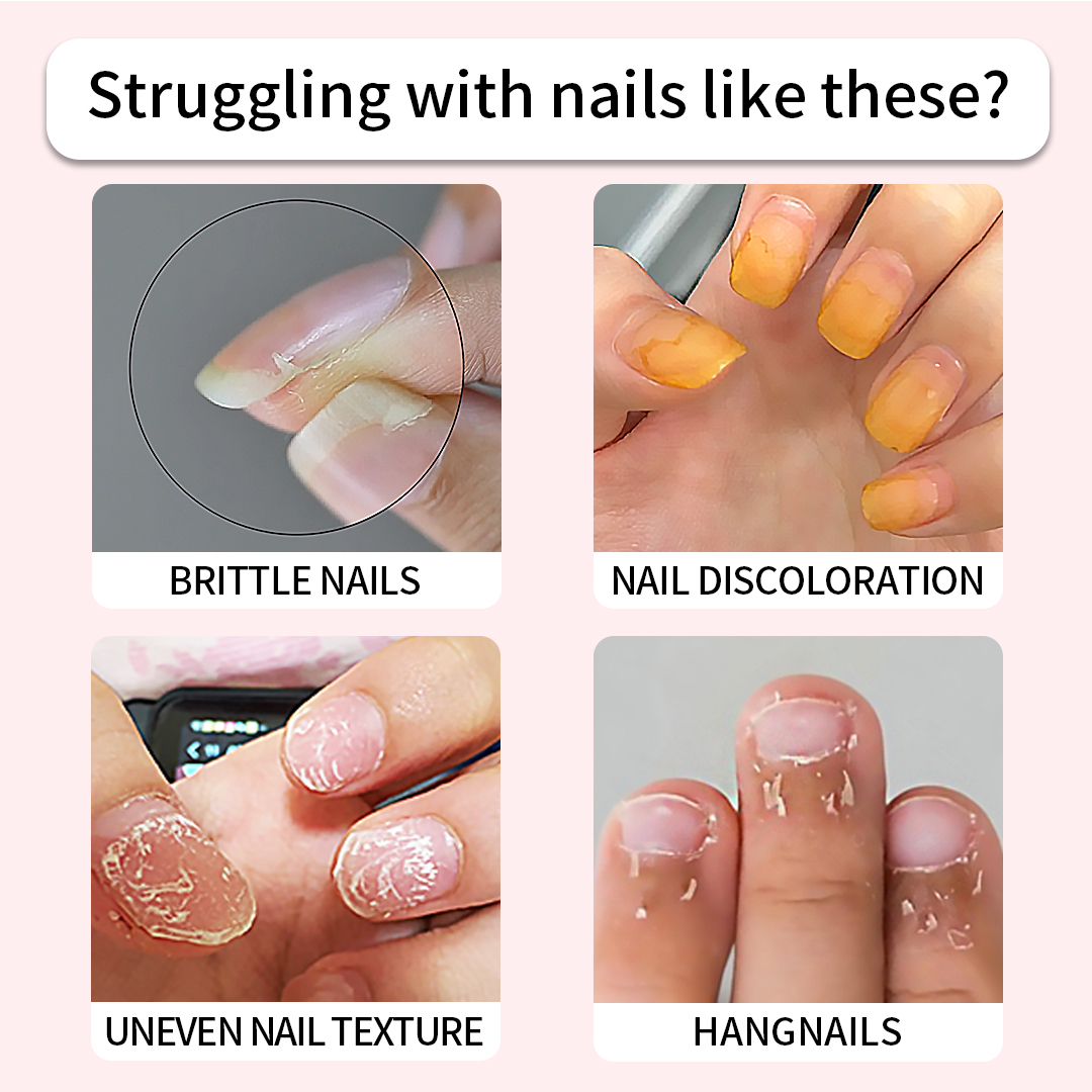 Nail Care Nourishes Oil Pen, Nailgrowthoil for Fingernail, Moistens And Protects Nails And Nails With Anti-Dead Skin Barbs,Rose flavor